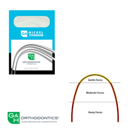 G4orce Progressive Force NiTi Trueform SoloPack